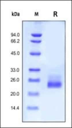 ACROBiosystems Recombinant Protein;ActiveMax Recombinant Human IL-6;HEK293;20UG;IL6,IL6,HGF,IL-6,Interleukin,Interleukin-6,Interleukin6,BSF2,HSF,IFNB2,
