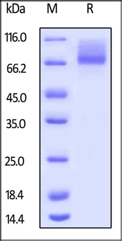 ACROBiosystems ACROBiosystems Human IL-7 R alpha / CD127 Protein, Mouse