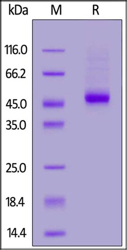 ACROBiosystems ACROBiosystems Canine IL-3 R alpha / CD123 Protein, His