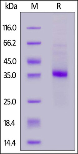 ACROBiosystems ACROBiosystems Canine IL-2 R beta Protein, His Tag, Quantity: