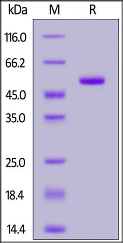 ACROBiosystems ACROBiosystems Human IL-1 beta / IL-1F2 Protein, Fc Tag