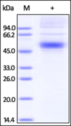 ACROBiosystems ACROBiosystems Human IL-5 R alpha / CD125 Protein, His Tag,