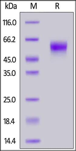 ACROBiosystems ACROBiosystems Human IL-2 R gamma / CD132 Protein, His Tag
