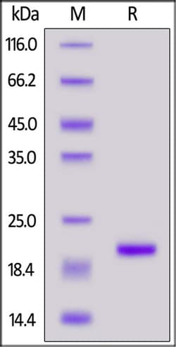 ACROBiosystems ACROBiosystems Cynomolgus IL-1 beta / IL-1F2 Protein, His