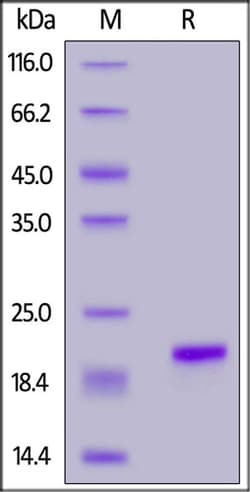 ACROBiosystems ACROBiosystems Human IL-1 beta / IL-1F2 Protein, His Tag