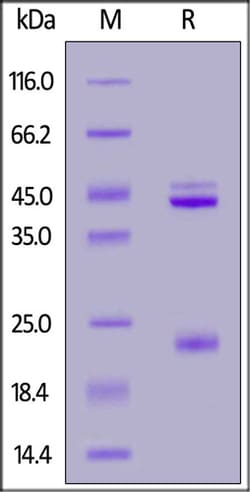ACROBiosystems ACROBiosystems Human IL-23 alpha & Rat IL-12 beta Heterodimer