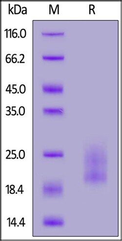 ACROBiosystems ACROBiosystems Human IL-17A&IL-17F Heterodimer Protein,