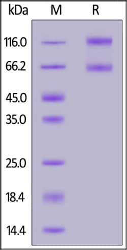 ACROBiosystems ACROBiosystems Biotinylated Cynomolgus IL-2 R beta, Quantity: