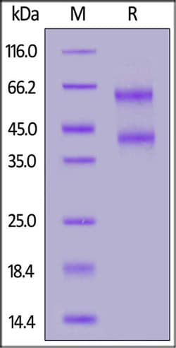 ACROBiosystems ACROBiosystems Human IL-2 R beta&IL-2 R gamma Heterodimer