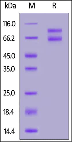 ACROBiosystems ACROBiosystems Biotinylated Human IL-2 R beta (MALS verified),