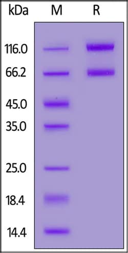 ACROBiosystems ACROBiosystems Biotinylated Human IL-2 R beta (MALS verified),
