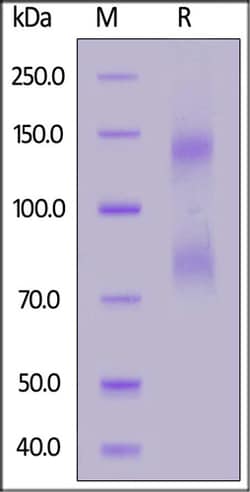ACROBiosystems ACROBiosystems Mouse IL-2 R beta&IL-2 R alpha&IL-2 R gamma
