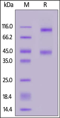 ACROBiosystems ACROBiosystems Rat IL-2 R beta&IL-2 R alpha&IL-2 R gamma