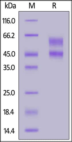 ACROBiosystems ACROBiosystems Rat IL-2 R beta&IL-2 R gamma Heterodimer