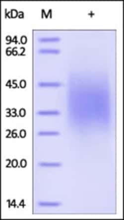 ACROBiosystems ACROBiosystems Human IL-18BP Protein, His Tag (MALS verified),