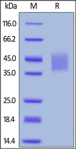 ACROBiosystems ACROBiosystems Human IL-4 R alpha / CD124 Protein, His Tag,