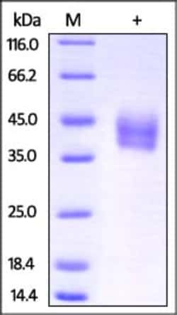 ACROBiosystems Recombinant Protein;Mouse IL-4 R alpha / CD124 Protein;HEK293;100UG;ILR,IL4R,IL-4R,IL4