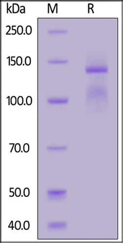 ACROBiosystems ACROBiosystems Mouse Integrin alpha 2 beta 1 (ITGA2&ITGB1)