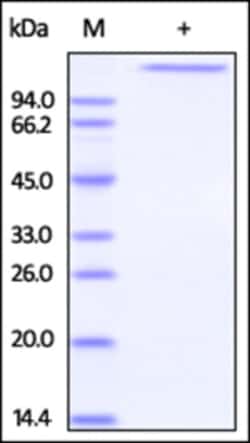ACROBiosystems Recombinant Protein;Human Jagged 1 / JAG1 Protein;HEK293;50UG;JA1,CD339,JAG1,Jagged1,hJ1,Jagged-1,JAGL1,JAG-1,