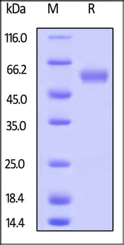 ACROBiosystems ACROBiosystems Human LAIR1 / CD305 Protein, Fc Tag, Quantity: