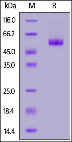 ACROBiosystems ACROBiosystems Human LAIR-1 Protein, Mouse IgG2a Fc Tag,