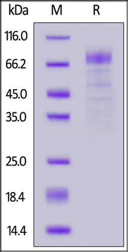 ACROBiosystems Human LGR4 / GPR48 protein, His Tag, Quantity: Each of 1