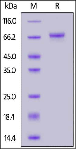 ACROBiosystems Human LGR5 / GPR49 protein, His Tag, Quantity: Each of 1