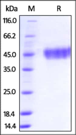 ACROBiosystems Recombinant Protein;Human Galectin-9 / LGALS9 Protein;HEK293;50UG;LG9,Galectin-9,LGALS9,Ecalectin,Galectin,Gal-9,