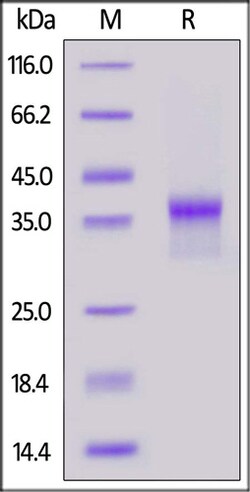 ACROBiosystems ACROBiosystems Biotinylated Human LILRB4 / CD85k / ILT3