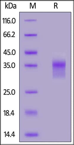 ACROBiosystems ACROBiosystems FITC-Labeled Human LILRB4 / CD85k / ILT3