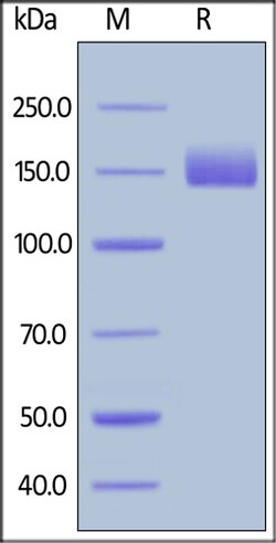 ACROBiosystems ACROBiosystems Human LIF R / CD118 Protein, Fc Tag, Quantity: