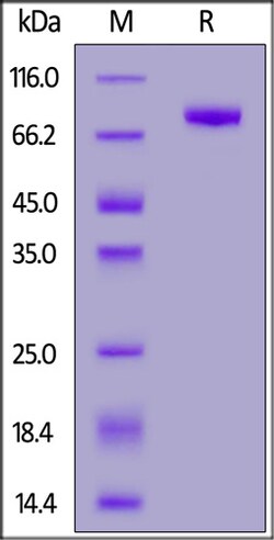ACROBiosystems Human LRRC15 / LIB Protein, His Tag, Quantity: Each of 1