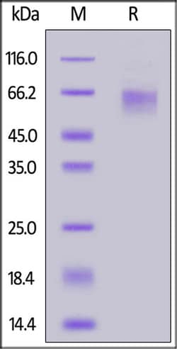 ACROBiosystems ACROBiosystems Cynomolgus LIV-1 / SLC39A6 Protein, His Tag,
