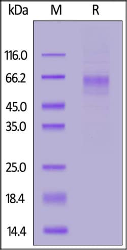 ACROBiosystems Human LIV-1 / SLC39A6 Protein, His Tag, Quantity: Each of