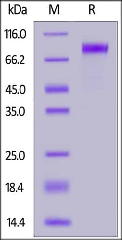 ACROBiosystems Human LIV-1 / SLC39A6 Protein, Fc Tag, Quantity: Each of
