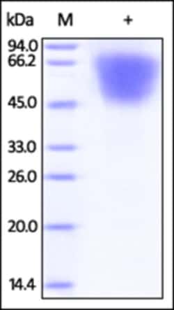 ACROBiosystems ACROBiosystems Human LYPD3 / C4.4A Protein, His Tag, Quantity: