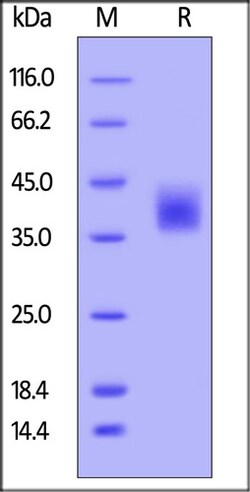 ACROBiosystems ACROBiosystems Human M-CSF / CSF-1 Protein, His Tag, Quantity: