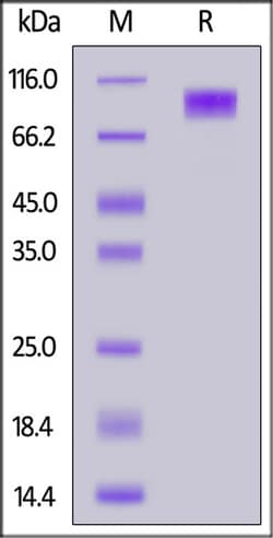 ACROBiosystems ACROBiosystems Mouse MCAM / CD146 Protein, His Tag, Quantity:
