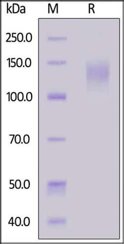 ACROBiosystems ACROBiosystems Human MERTK / Mer Protein, Fc Tag, Quantity: