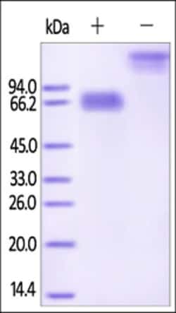 ACROBiosystems Recombinant Protein;Human Mesothelin / MSLN (296-580) Protein,