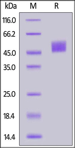 ACROBiosystems ACROBiosystems Biotinylated Mouse Mesothelin / MSLN Protein,