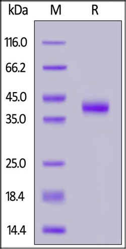 ACROBiosystems Human Mucin-1 / MUC-1 (116-173) Protein, Fc Tag, Quantity: