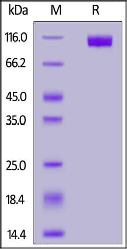 ACROBiosystems Human NCAM-1 / CD56 Protein, His Tag, Quantity: Each of