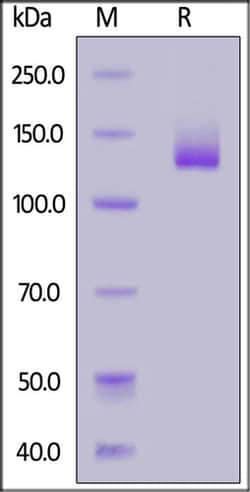 ACROBiosystems ACROBiosystems FITC-Labeled Human NCAM-1 / CD56 Protein,