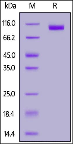 ACROBiosystems ACROBiosystems FITC-Labeled Human NCAM-1 / CD56 Protein,