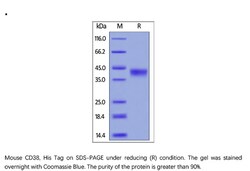 ACROBiosystems Recombinant Protein;Mouse CD38 Protein;HEK293;100UG;CD8,CD38,T10,cADPr