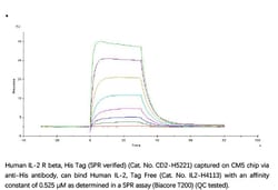ACROBiosystems Human IL-2 R beta / CD122 Protein, His Tag (SPR verified),