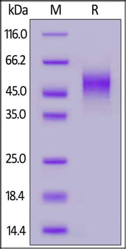 ACROBiosystems ACROBiosystems Biotinylated Human NKG2C (MALS verified),