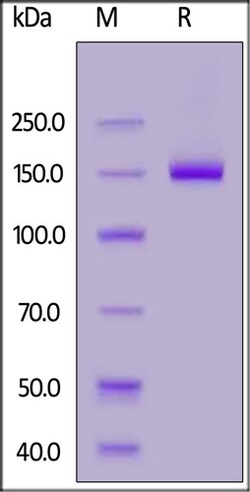 ACROBiosystems ACROBiosystems Human Netrin receptor DCC / DCC Protein,