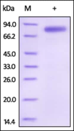 ACROBiosystems ACROBiosystems Human IL-12B / NKSF2 / p40 Protein, Fc Tag,